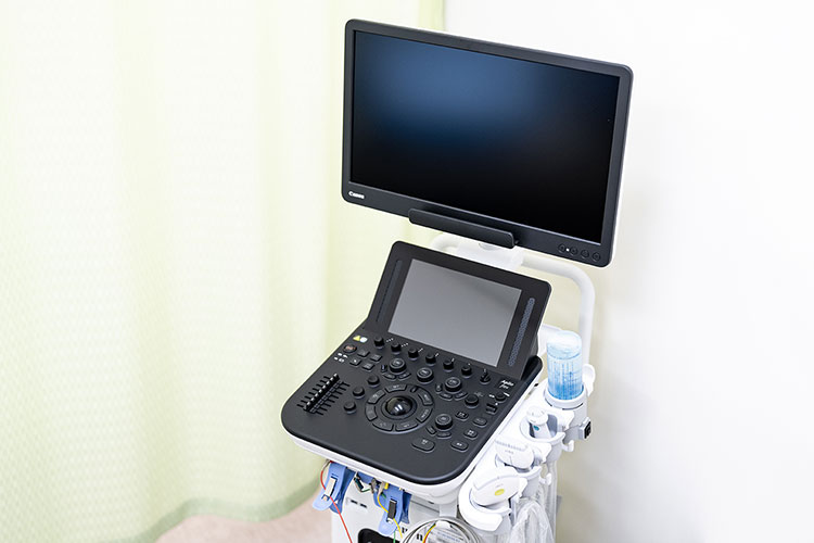 カラードップラー超音波検査装置